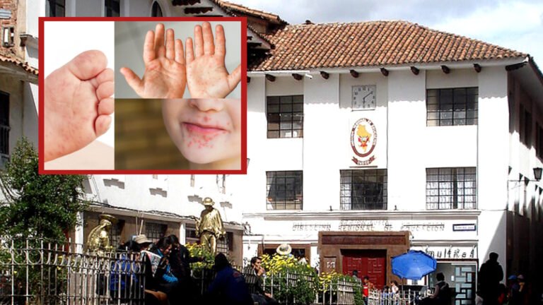 Mano boca pie cusco